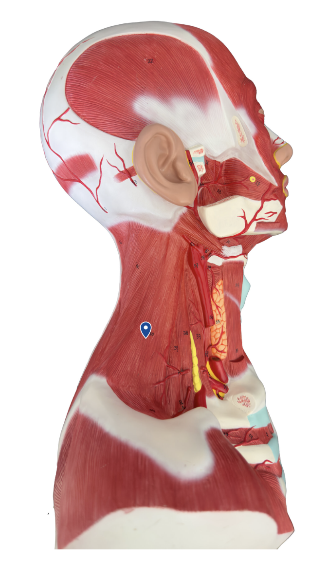 <p>What muscle is the arrow pointing to?</p>