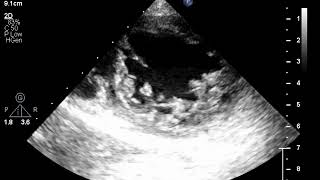 <p>What is seen in this 2D image?</p>