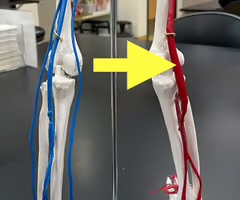 <p>Name the blood vessel.</p>