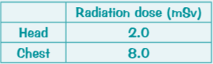 <p>What does a CT scan use to build up a picture? What does the table show? If a patient has a CT scan oh their chest…?</p>