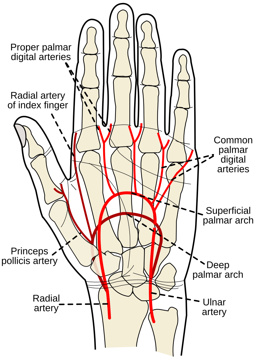 <p>formed predominantly by the ulnar artery with a superficial palmar branch of the radial artery; referred to as the superficial palmar arch</p>