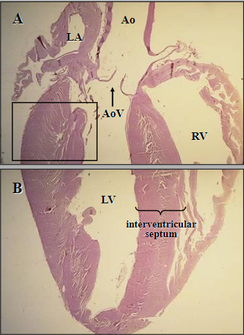What organ is being shown