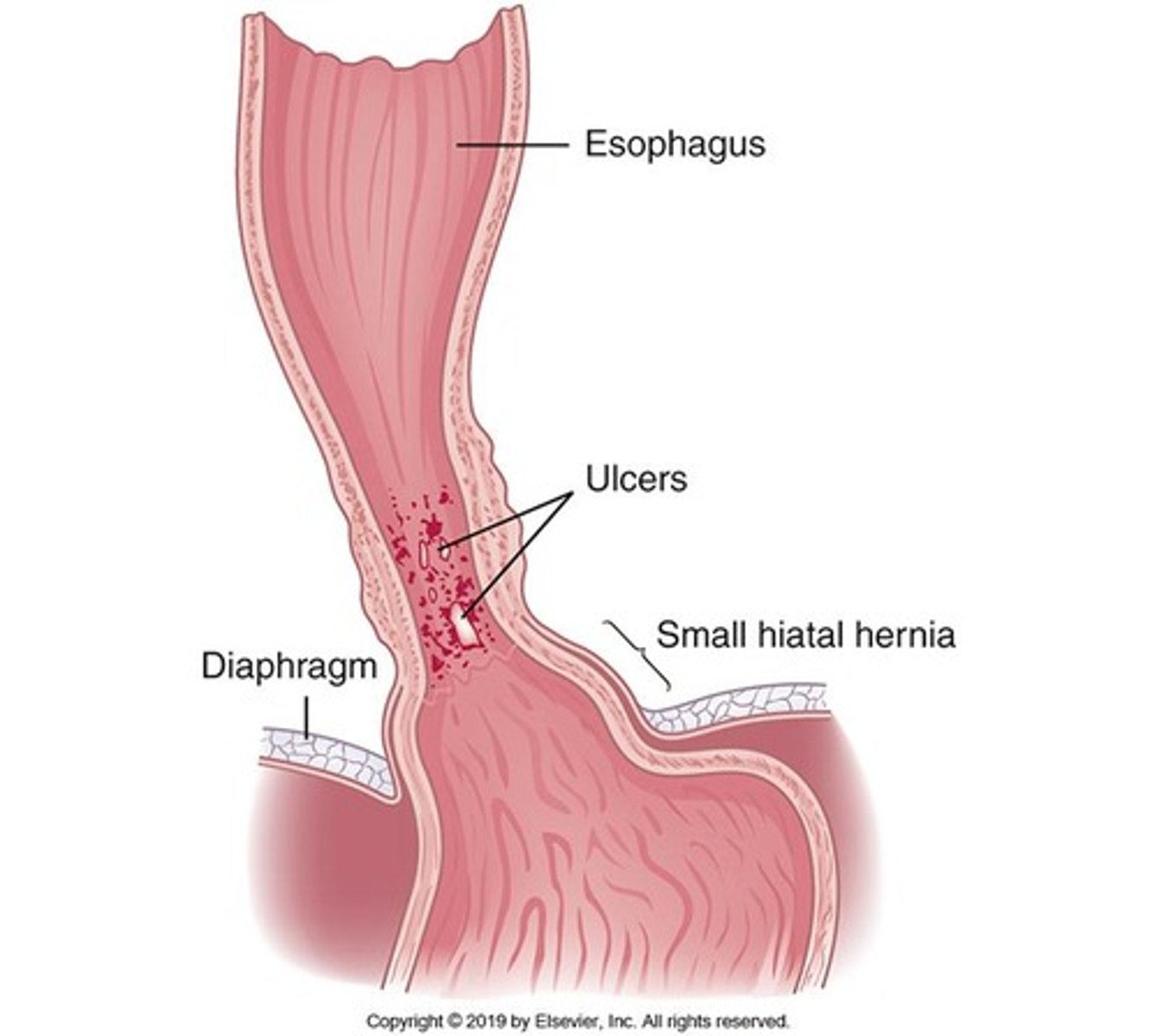 <p>Bowel retraining, moderate exercise, increased fluid and fiber intake, enemas, biofeedback for dyssynergic defecation, and medications like colonic secretagogues and laxatives.</p>