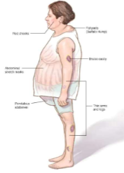 <p>A patient who has been using high doses of corticosteroid medication mentions seeing changes in their body. Based on the clinical symptoms, what can be assumed here? </p>