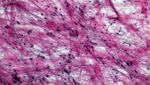<p>Loose connective tissue of adipocytes that stores fat and insulates the body.</p>