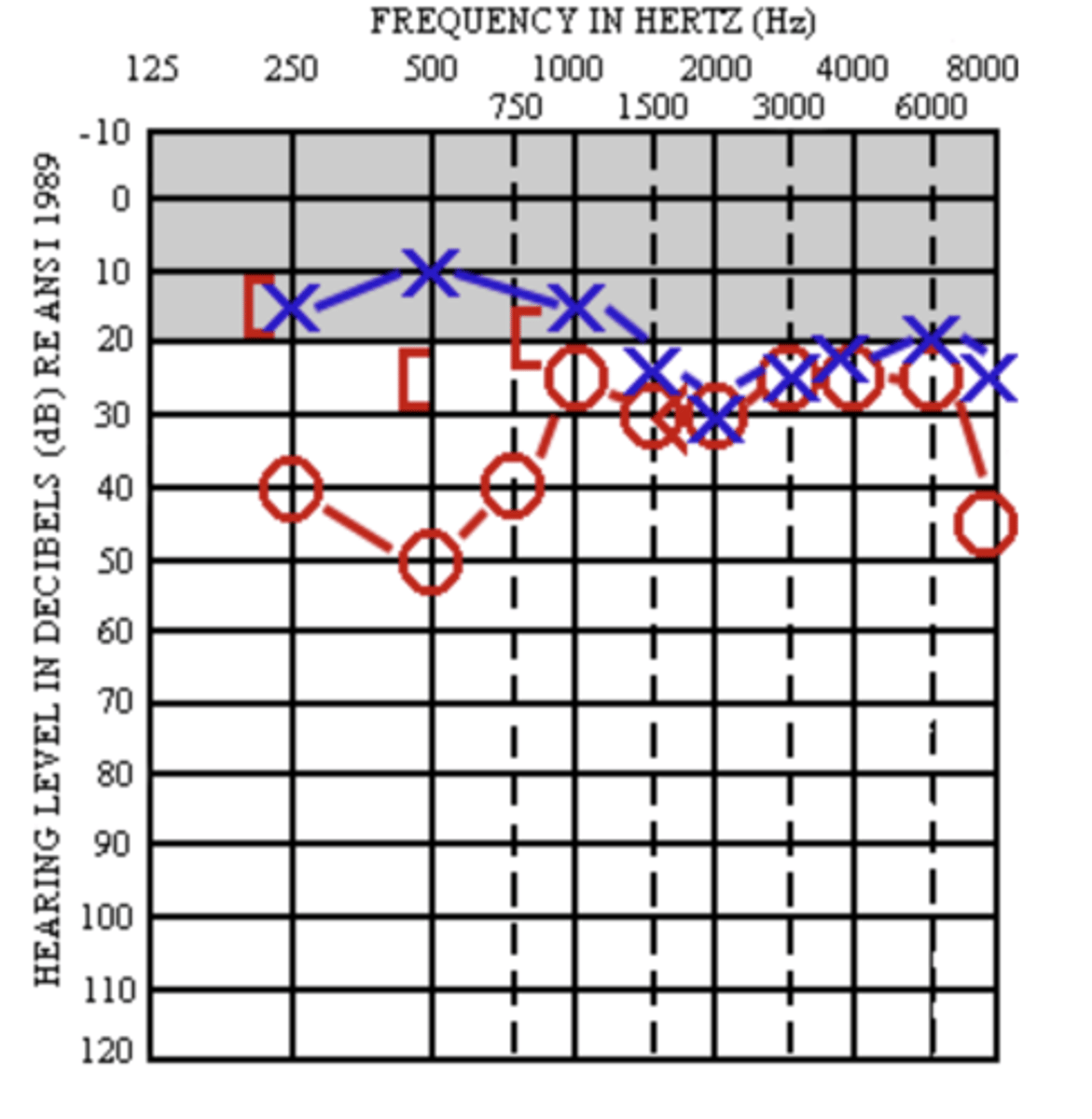 <p>- do each ear independently, add up all frequencies from 500, 1K, and 2K, then divide by 3.</p><p>practice ex:</p><p>- AC left ear: 10+15+30/ 3 = 18.333 dB HL</p><p>- AC right ear: 50+25+30 / 3 = 35 dB HL</p>