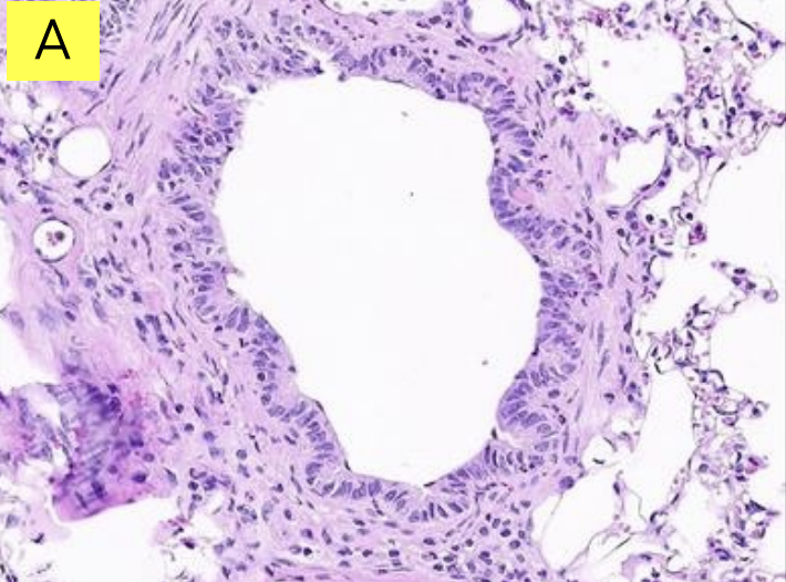 <p>Bronchiole </p>
