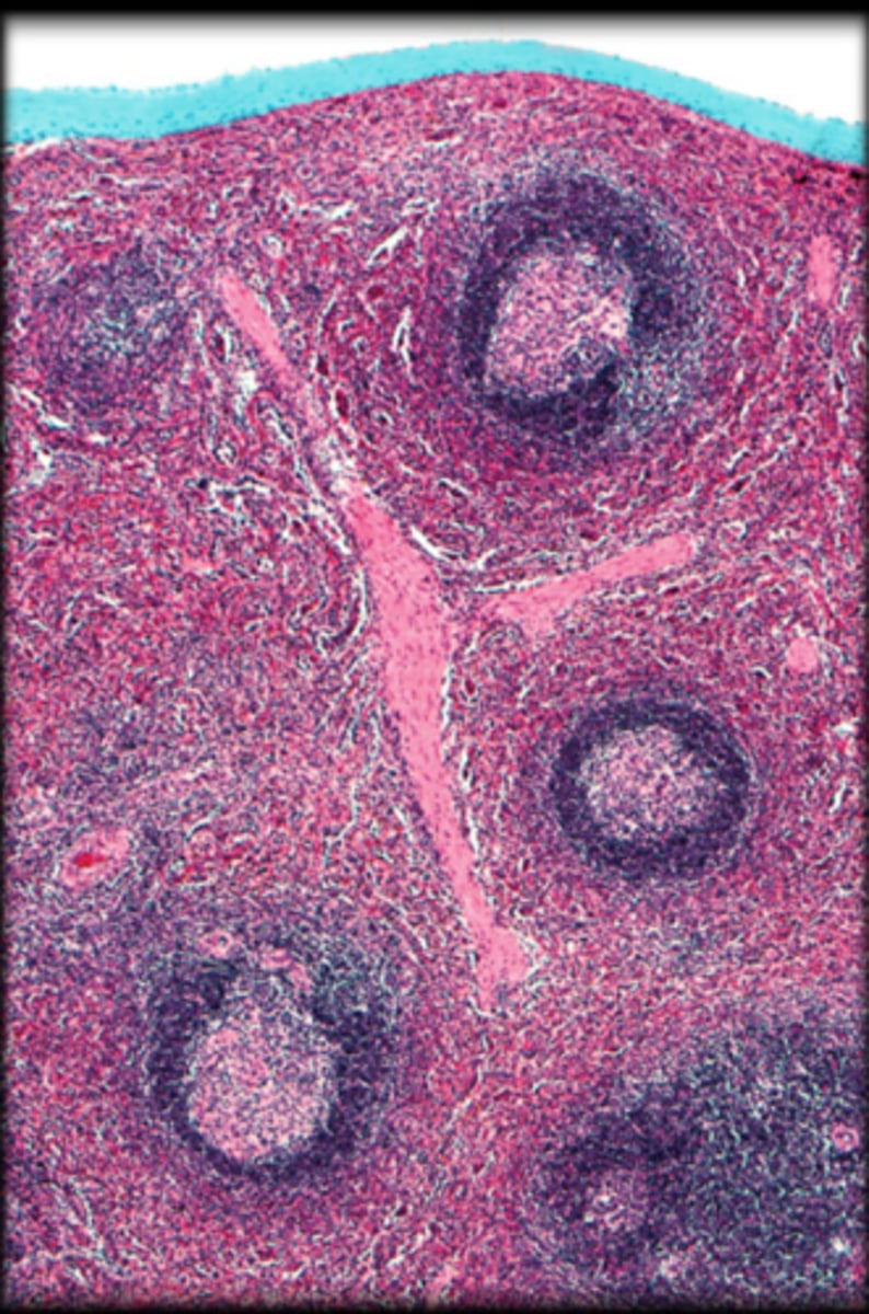 <p>Spleen</p>