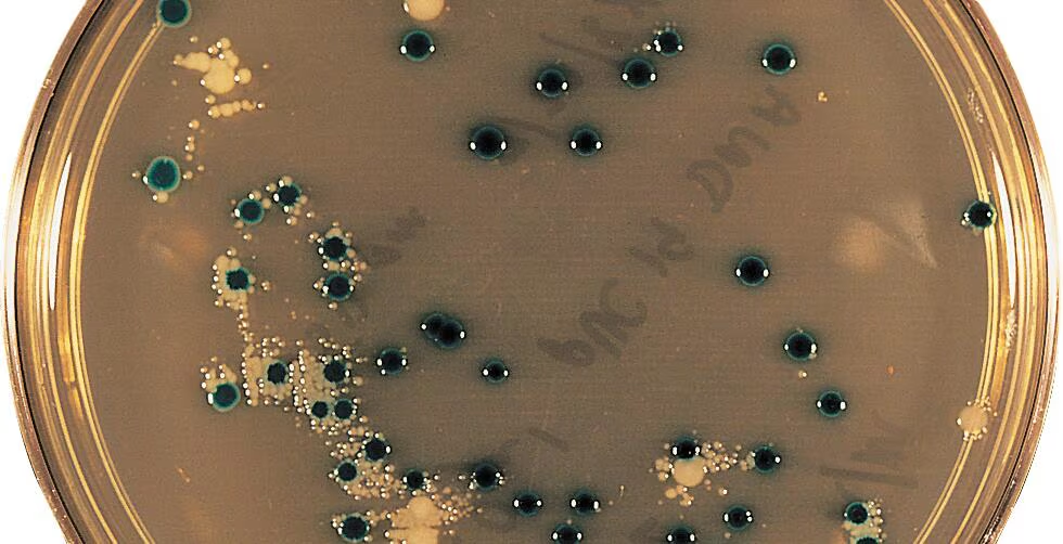 <p>The following picture shows bacterial colonies growing on plus ampicillin in a blue-white screening test. </p><p>Which colonies have the recombinant plasmid? </p><p>The small satellite colonies do not have the plasmid. Why did they start growing on the medium after the larger colonies?</p>