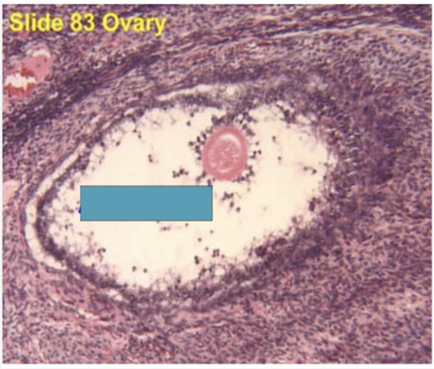 <p>Identify the structure</p>