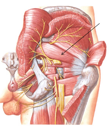 <p>What is the innervation of this muscle?</p>