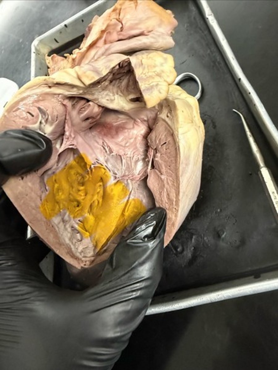 <p>back wall on both sides</p>