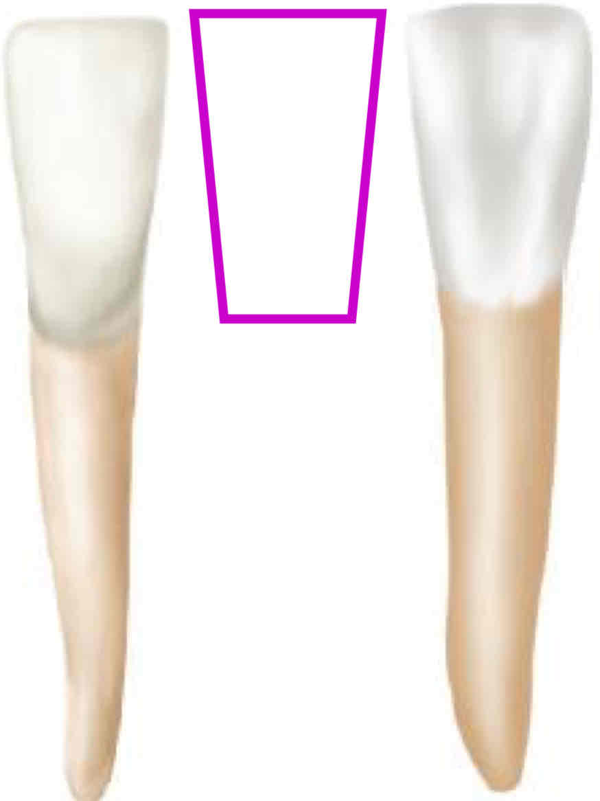 <p>what is the GEOMETRIC outline for the facial and lingual aspect of the mandibular right central incisor?</p>