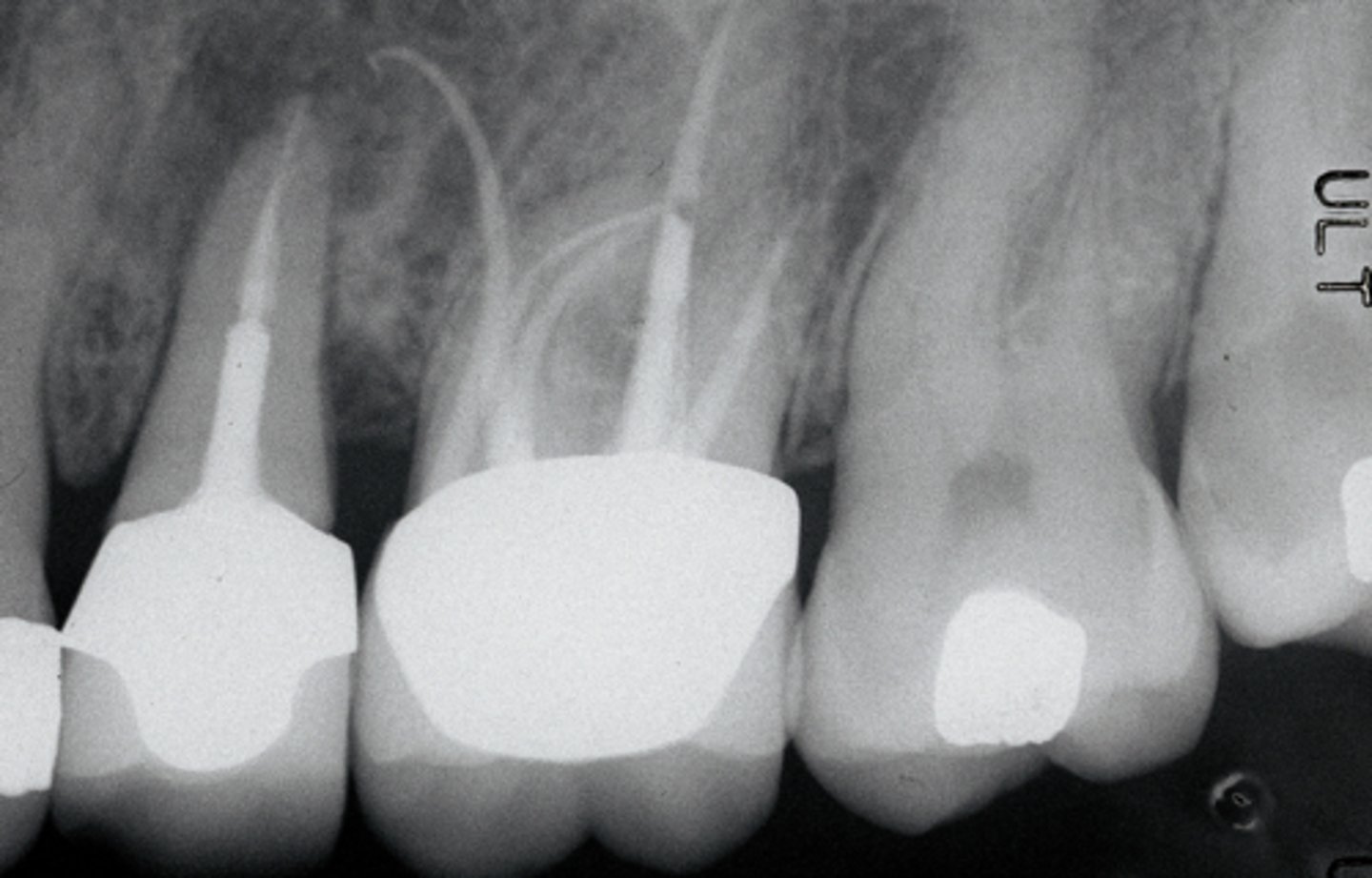 <p>ID the procedural error:</p>