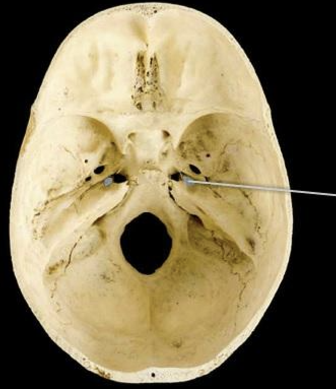 <p>carotid canal</p>