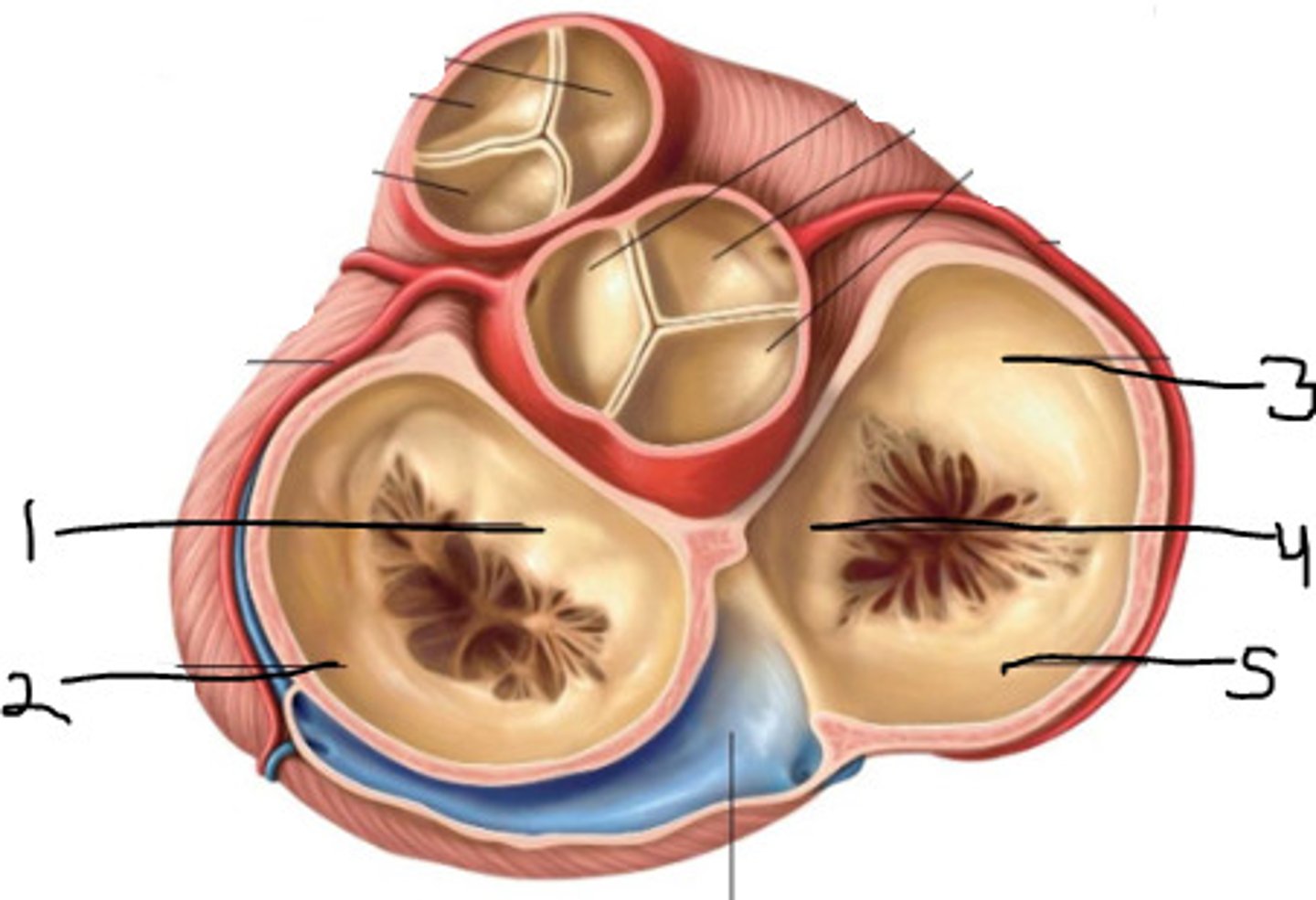 <p>Name Structure 3 (Part of Right Ventricle)</p>