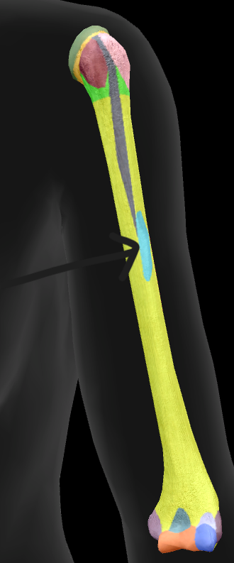 term image