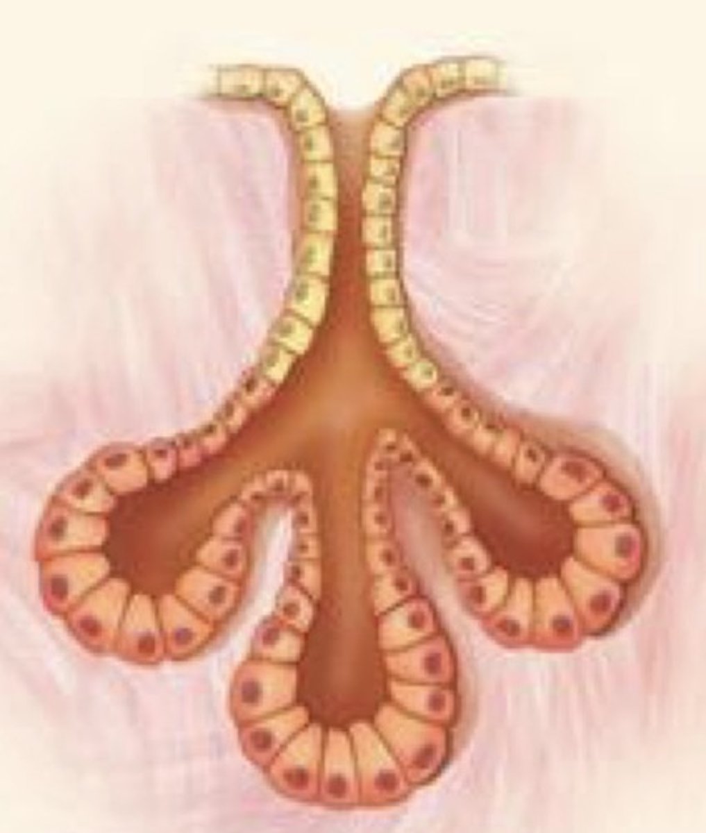 <p>What gland duct type is this?</p>