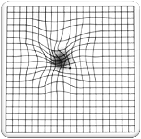 <p>amsler visual grid</p>