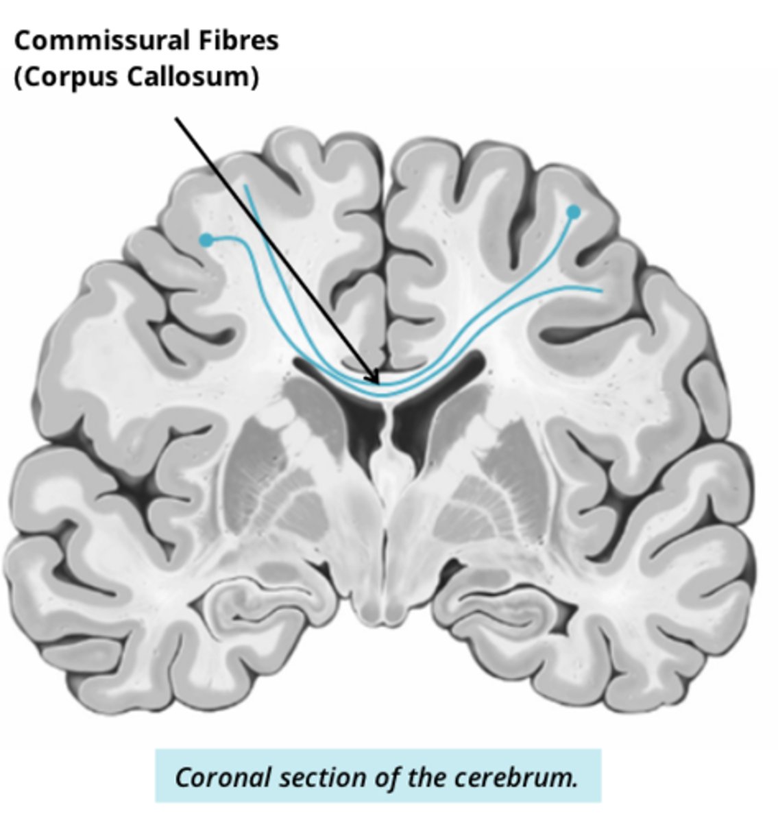 <p>connect L and R hemispheres of cerebrum</p>