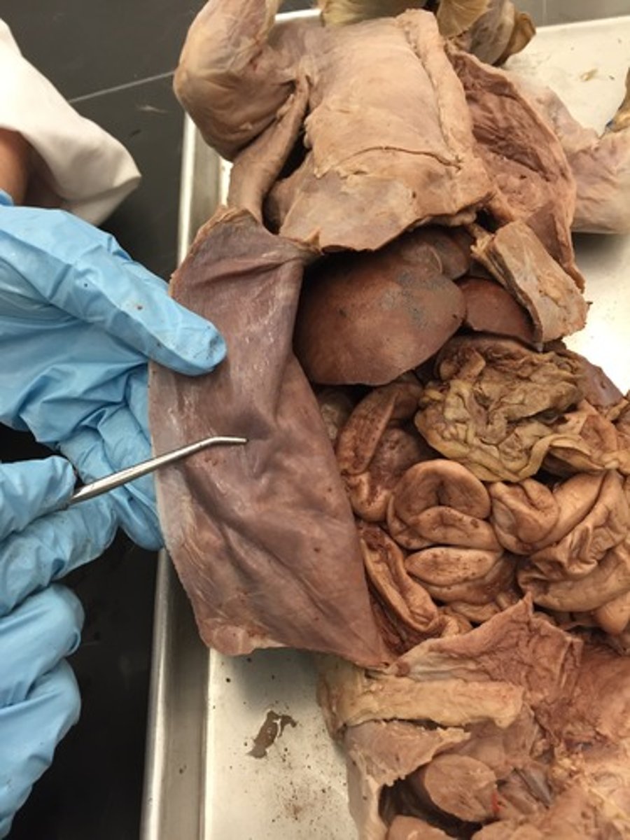 <p>The outer layer of the peritoneum that lines the abdominal cavity.</p>