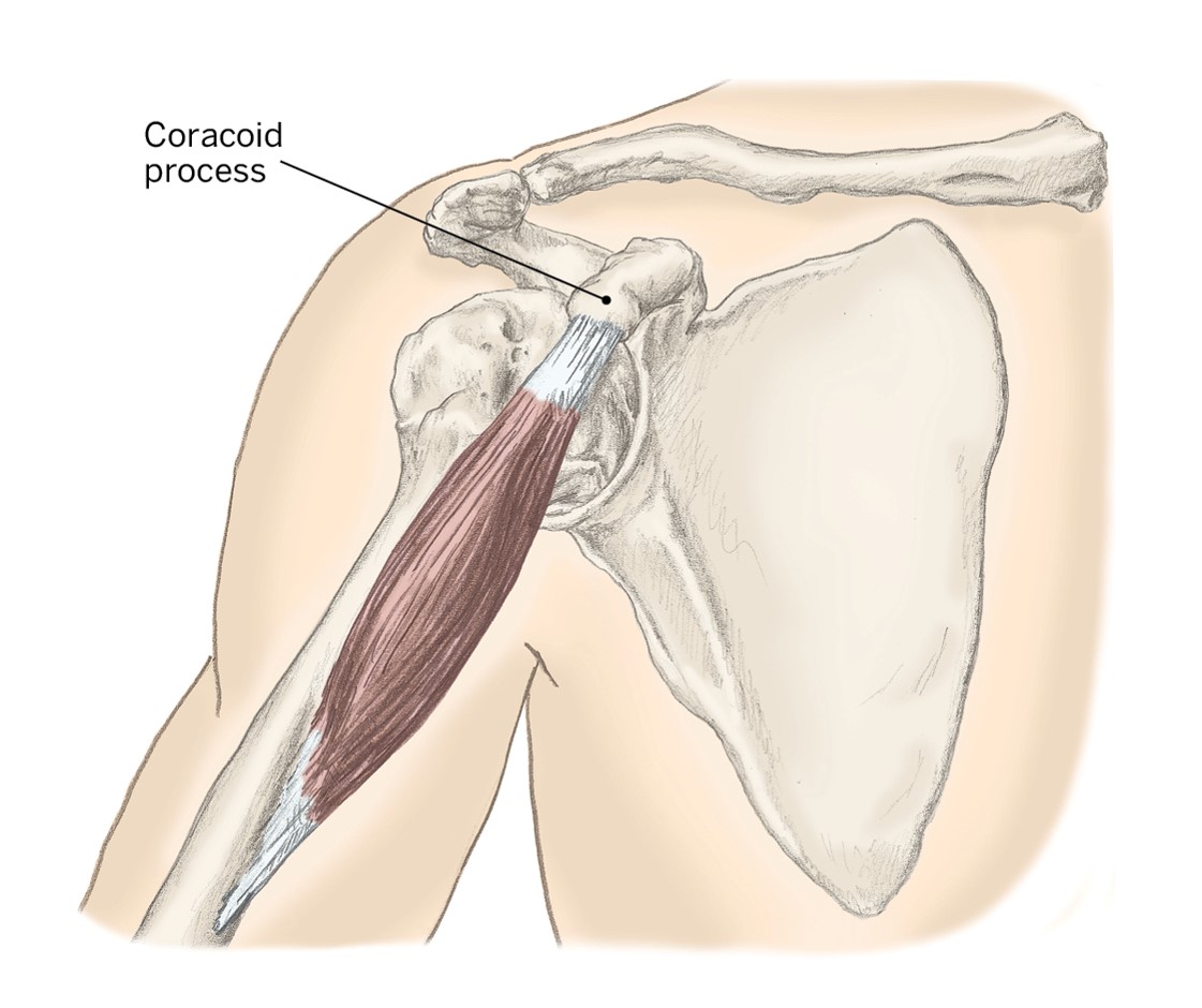 <p>O- Coracoid Process of the scapula</p><p>I- Medial Humerus</p><p>A- Shoulder Adduction &amp; Flexion</p>
