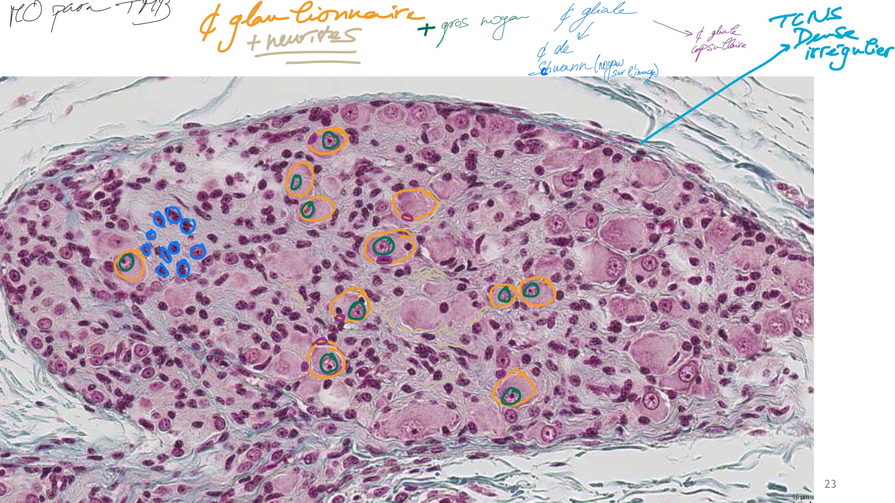 <p>MO, paraffine, TMB </p><p>Glanglions nerveux avec des cellules ganglionnaires (gros noyaux) + neurites </p><p>Cellules gliales (cellules de Swchann et cellule gliale capsulaire </p><p>Capsule fibreux (TCNs dense irrégulier) </p>