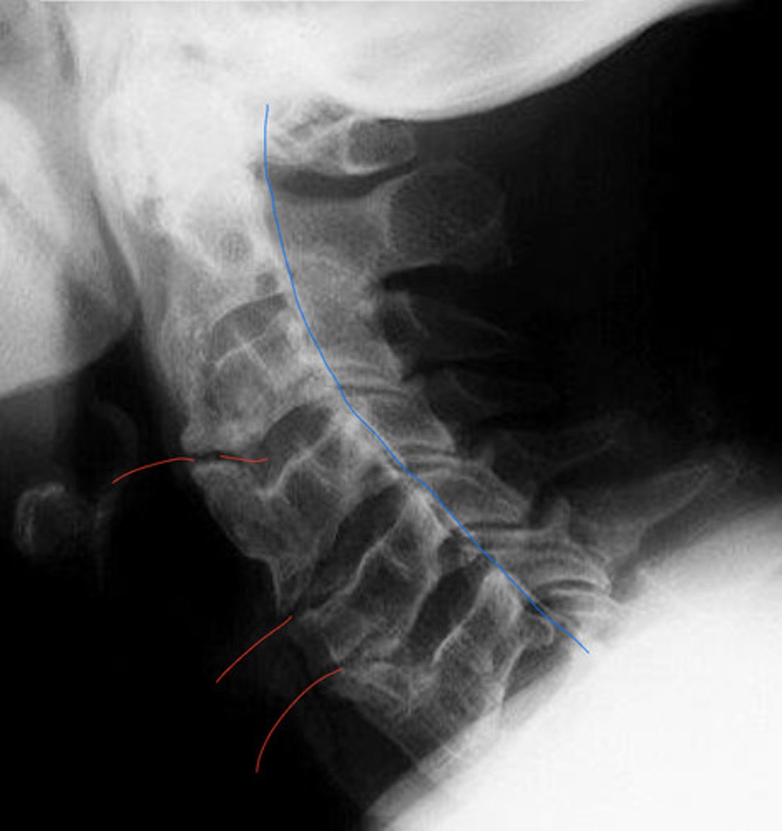 <p>What is the blue?</p><p>What is the red?</p>