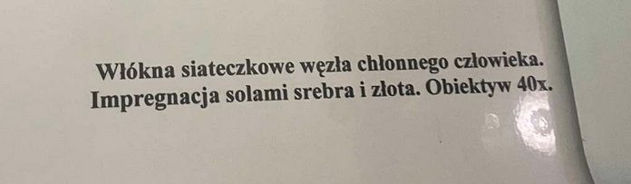 <p>zbudowane z kolagenu, stanowią rusztowanie dla komórek</p>
