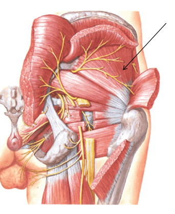 <p>What is the insertion of this muscle?</p>