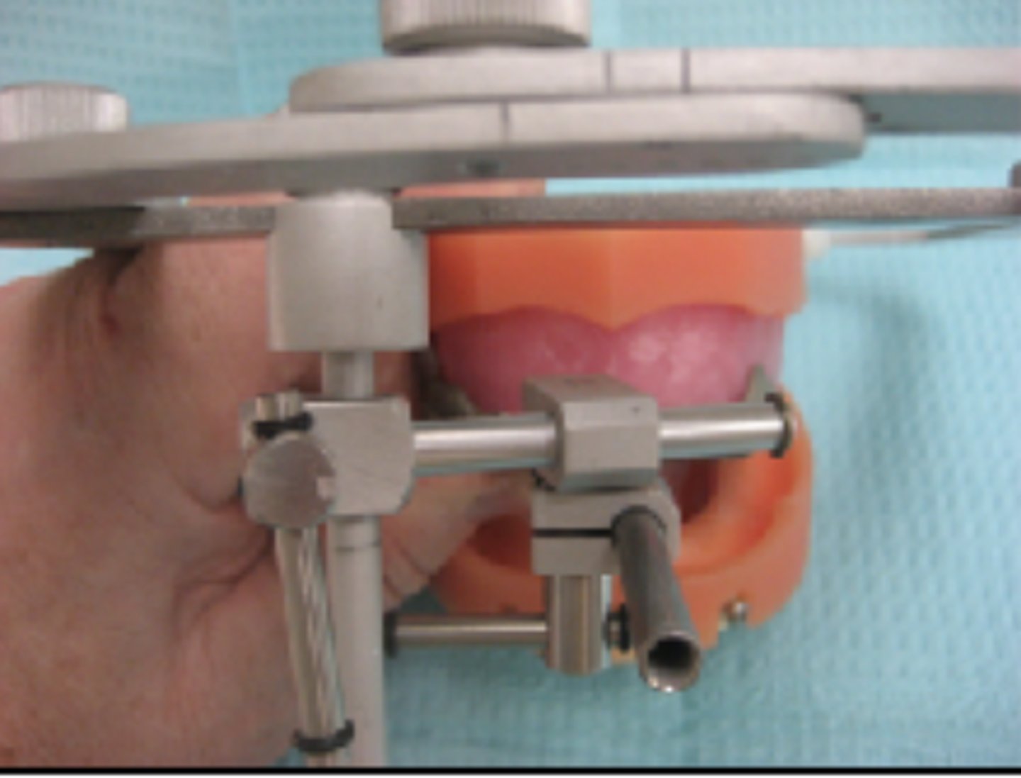 <p>When seating the record base-wax rim on the maxillary arch, what alignment is essential?</p>