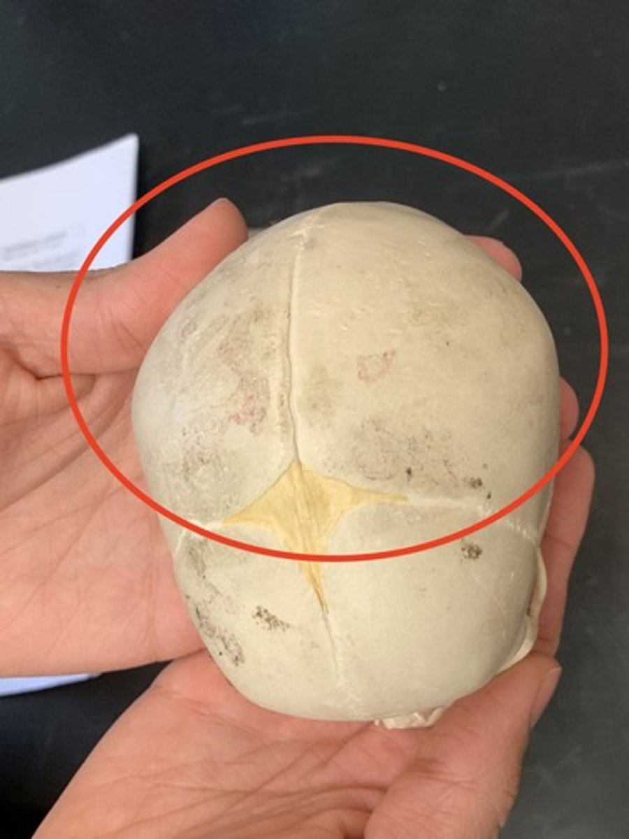 <p>-the parietal bone</p>