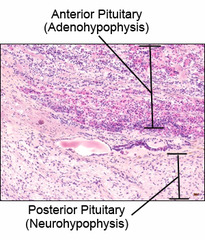 darker staining-- more spots, blood vessels