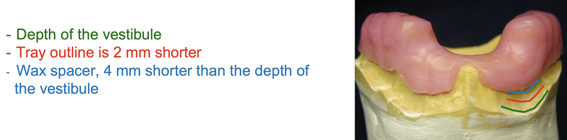 <ul><li><p>one at depth of vestibule</p></li><li><p>one outline of custom tray 2mm short of vestibule</p></li><li><p>one outline of wax spacer 2mm short of tray outline (optional)</p></li></ul><p>*maxilla and mandible</p>