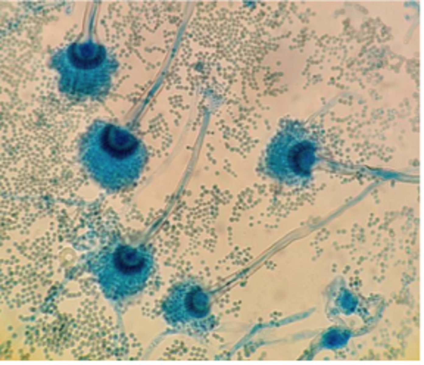 <p>During winter months, several cows abort in one herd. The farmer recently opened a moldy silage bale. Placental histopathology shows septate hyphae with parallel walls and dichotomous 45° branching, consistent with _____________________</p>