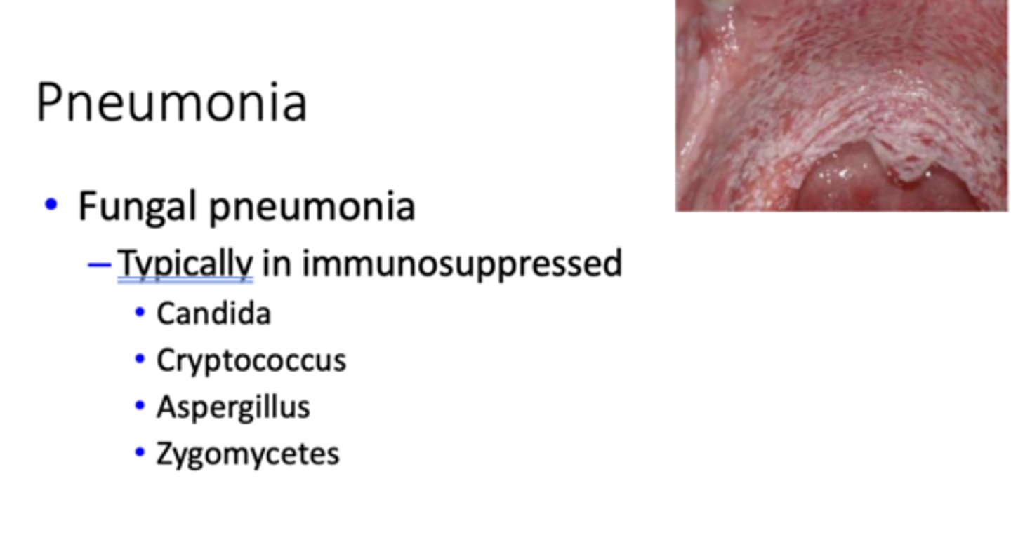 <p>immunosuppressed</p>