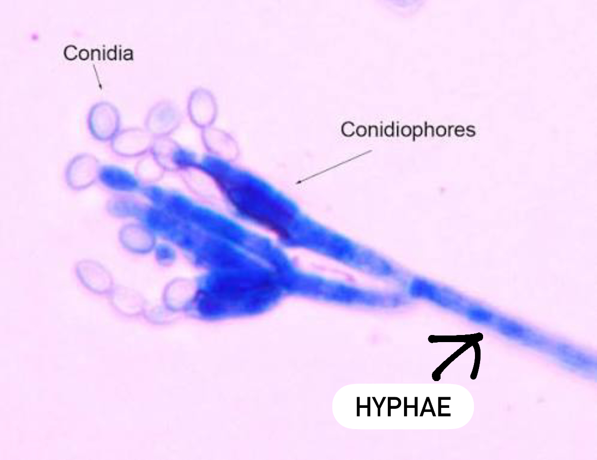 <p>Domain: Eukarya</p><p>Kingdom: Fungi</p><p>Clade: Ascomycota</p>