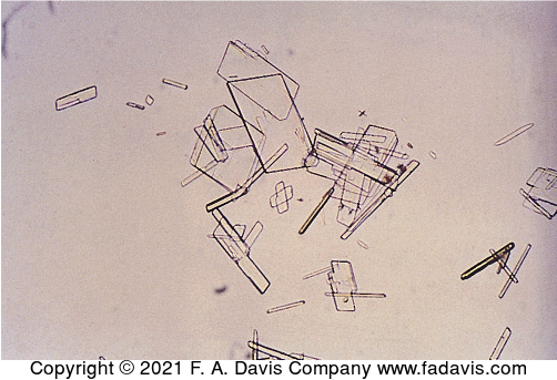 <p>name this crystal? what is it associated with? what is its pH? normal or abnormal? what is a key feature?</p>
