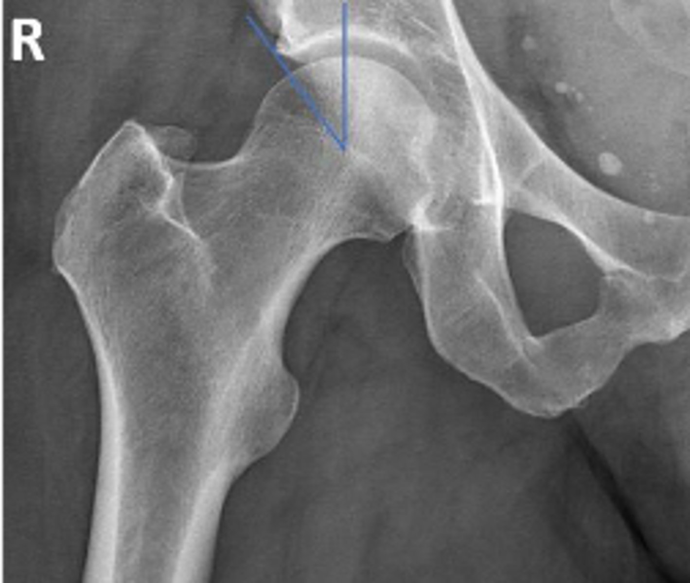<p>What is the radiographic view?</p>