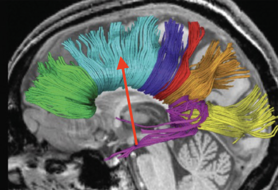 <p>connects posterior right and left frontal lobes, right and left parietal lobes</p>