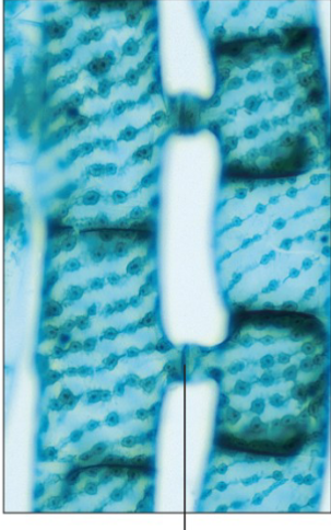 <p>What part of the Spirogyra is the line on the bottom pointing to?</p>