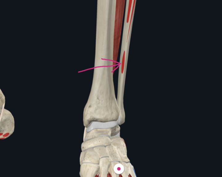 <p>Origin: Peroneus Tertius</p>