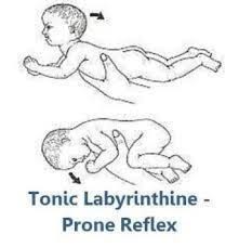 <ul><li><p><strong>stimulus: </strong>place infant in prone</p></li><li><p><strong>response: </strong>increased <strong>flexor </strong>tone</p></li><li><p><strong>fxn sig:</strong></p><ul><li><p>facilitates full body <strong>flexor </strong>tone</p></li><li><p>allows posture to adapt to head</p></li></ul></li><li><p><strong>onset age: </strong>37 wks gestation</p></li><li><p><strong>integration: </strong>6mos</p></li></ul><p></p>