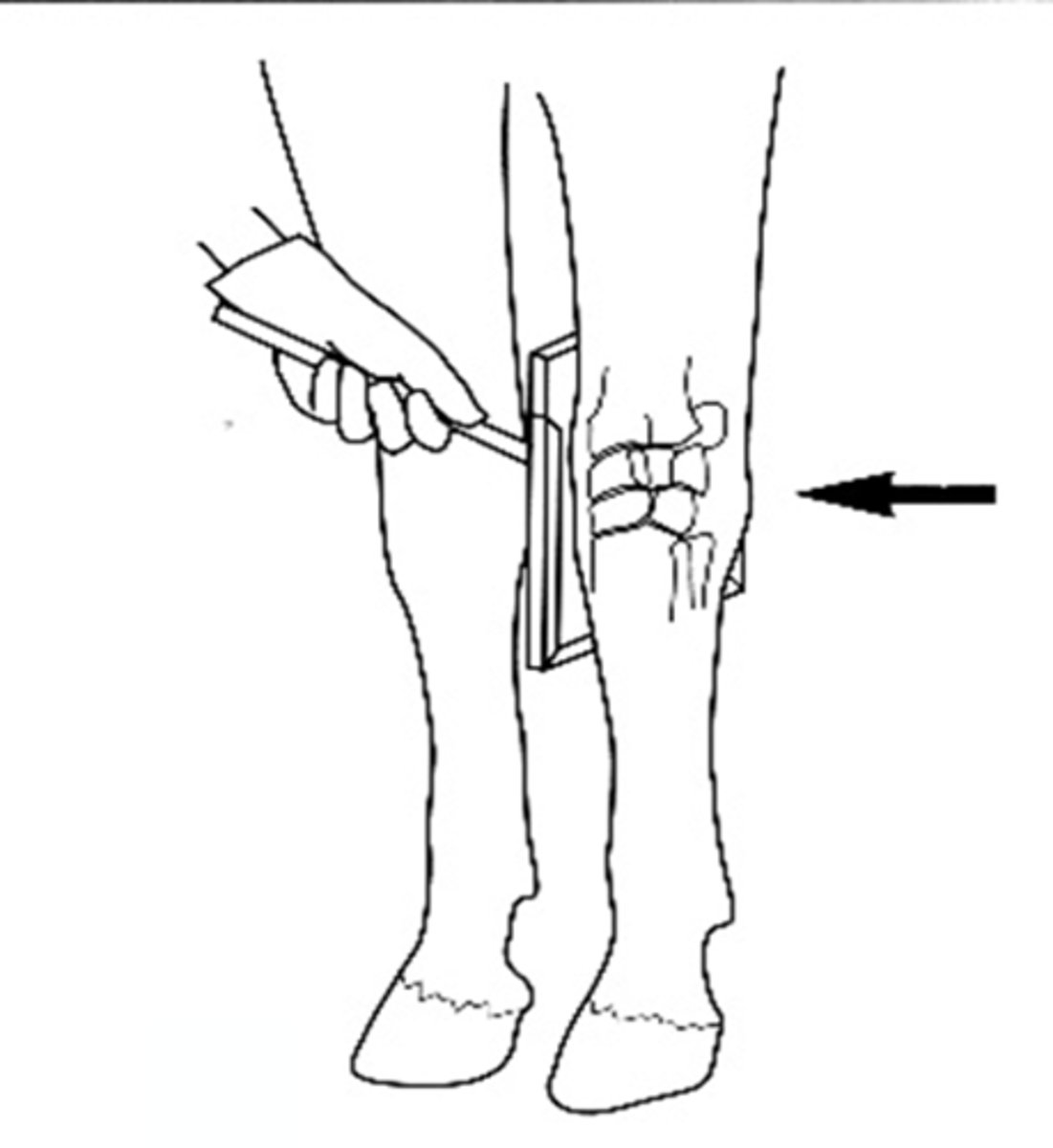 <p>What view is being taken?</p>