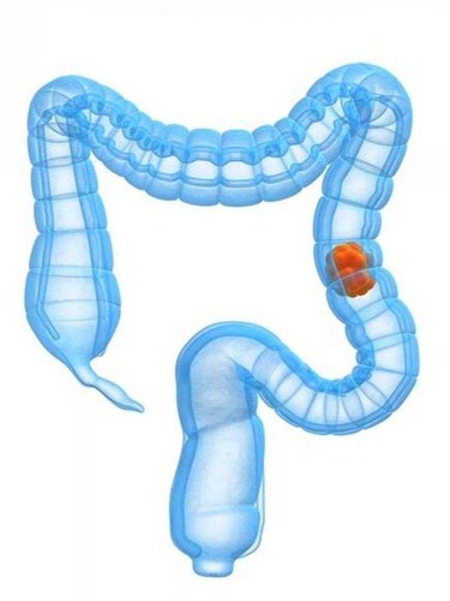 <p>the long tube that carries solid waste from the stomach out of the body:</p><p>He has trouble with his b_______ .</p>