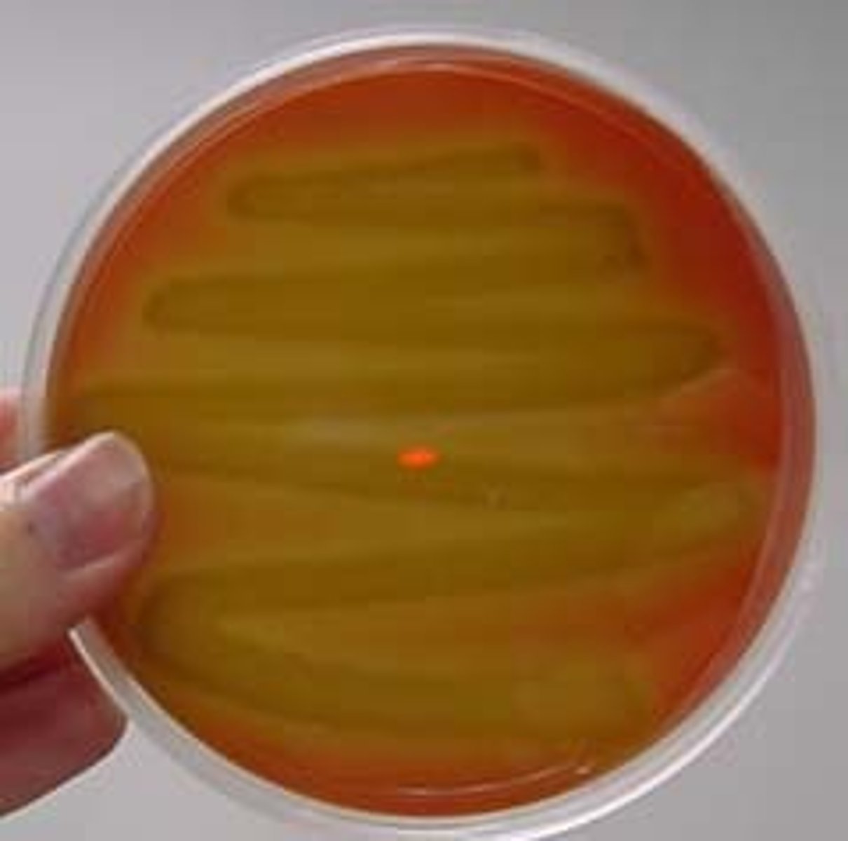 <p>Partial lysis; greenish discoloration</p>