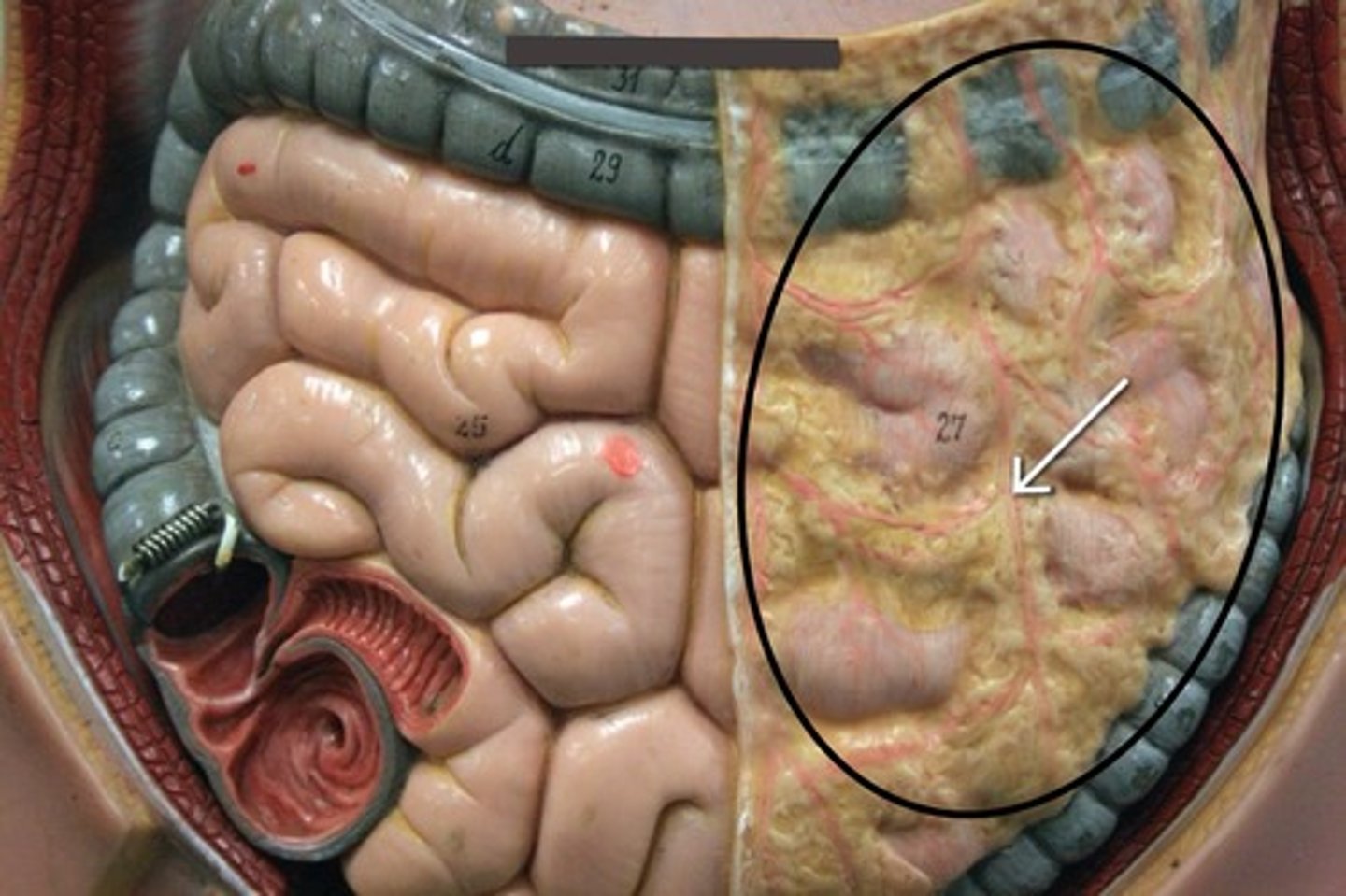 <p>Fatty region</p>