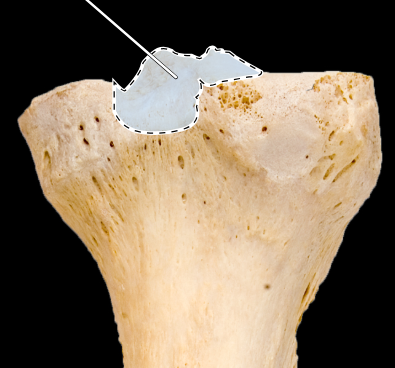 <p>Tibia, posterior view, right side, proximal end</p>