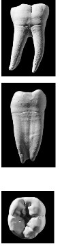 <p>Which tooth is this?</p>