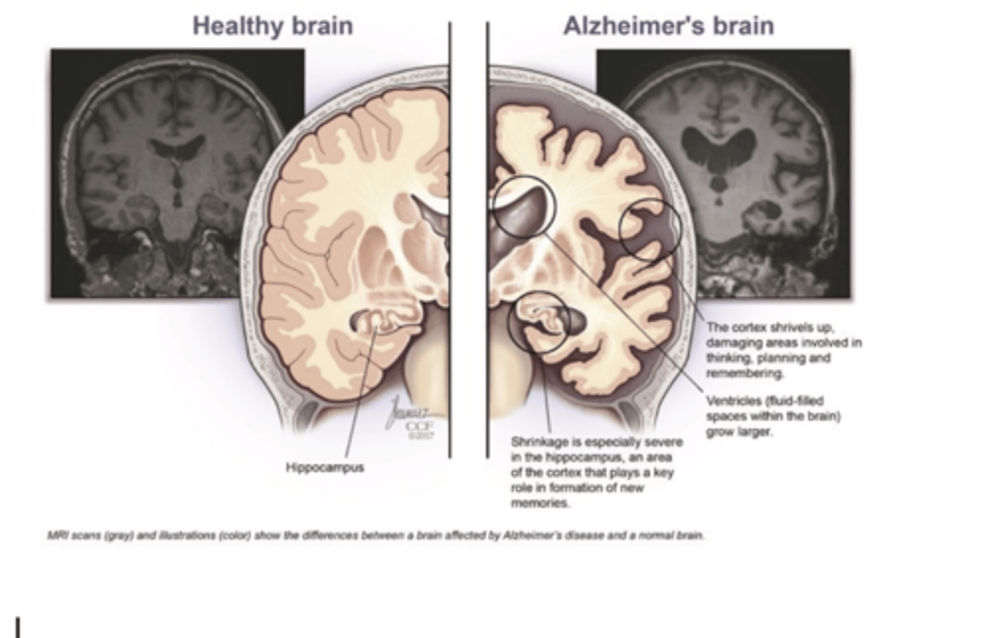 <p>are useful for clinical imaging (diagnosis)</p>